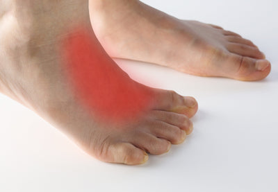 Top of the Foot Pain: Causes, Treatments, and Prevention Tips